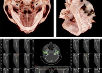 Zahnspange-Warendorf_Dr-Ulrich-und-Katja-Kritzler_FAQ_Diagnose-4.jpg